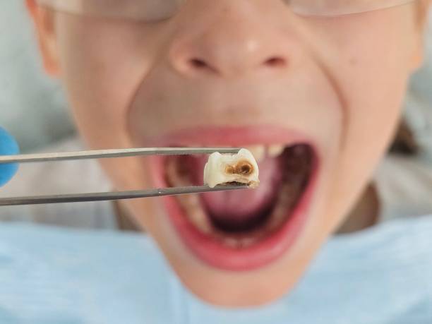 Best Walk-In Dentist Near Me  in Crawfordsville, IN